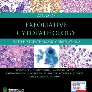 Atlas of Exfoliative Cytopathology With Histopathologic Correlations 1st Edition