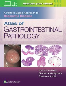 Atlas of Gastrointestinal Pathology: A Pattern Based Approach to Neoplastic Biopsies 1st Edition