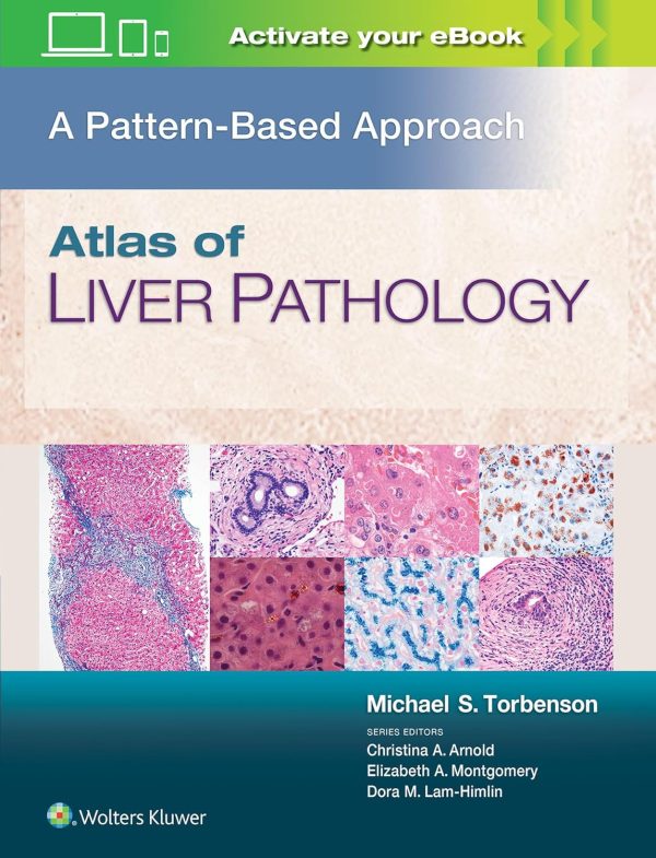 Atlas of Liver Pathology A Pattern-Based Approach 1st Edition