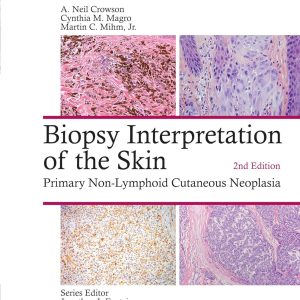 Biopsy Interpretation of the Skin: Primary Non-Lymphoid Cutaneous Neoplasia (Biopsy Interpretation Series) 2nd Edition Second ed pdf