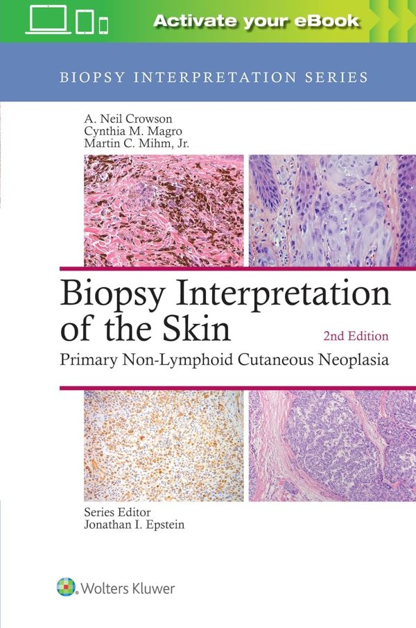 Biopsy Interpretation of the Skin: Primary Non-Lymphoid Cutaneous Neoplasia 2nd Edition