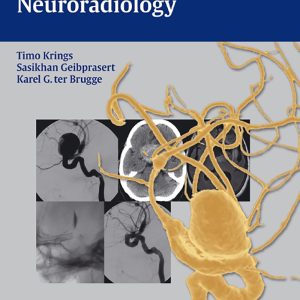 Case-Based Interventional Neuroradiology 1st Edition