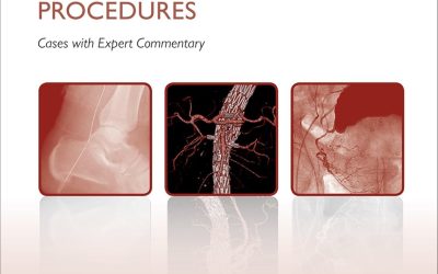 Challenging Concepts in Interventional Radiology (Challenging Cases) 1st Edition