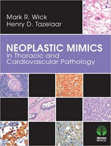 Neoplastic Mimics in Thoracic and Cardiovascular Pathology 1st Edition