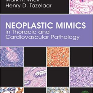 Neoplastic Mimics in Thoracic and Cardiovascular Pathology 1st Edition