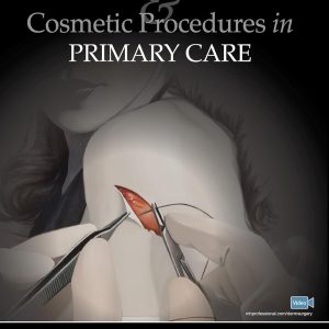 Dermatologic Surgery and Cosmetic Procedures in Primary Care Practice 1st Edition