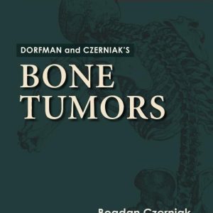 Dorfman and Czerniak’s Bone Tumors 2nd Edition