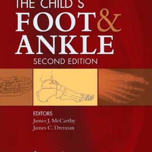 Drennan's The Child's Foot and Ankle 2nd Edition Second ed pdf