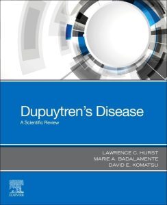 Dupuytren's Disease: A Scientific Review 1st Edition