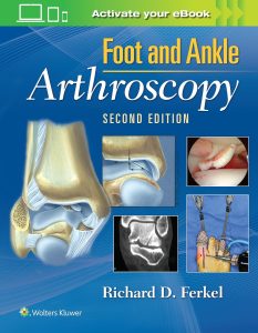 Foot & and Ankle Arthroscopy 2nd Edition