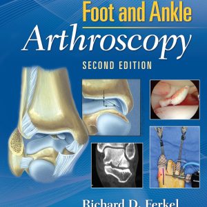 Foot & and Ankle Arthroscopy 2nd Edition