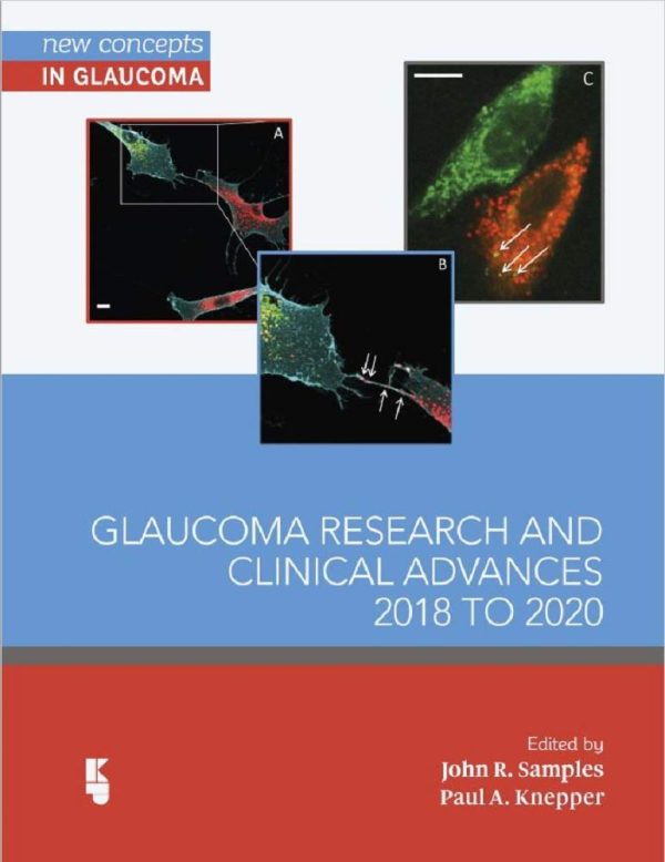 Glaucoma Research and Clinical Advances 2018 to 2020  (New Concepts in Glaucoma series Book 1 & 2)