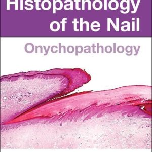 Histopathology of the Nail – Onychopathology