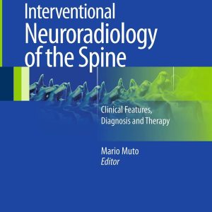 Interventional Neuroradiology of the Spine: Clinical Features, Diagnosis and Therapy 1st Edition