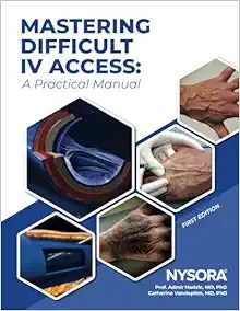 Mastering Difficult IV Access – A Practical Manual 1st Edition