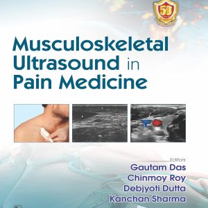 Musculoskeletal Utrasound in Pain Medicine