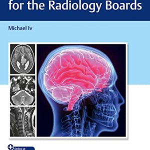 Neuroradiology Q&A for the Radiology Boards 1st Edition