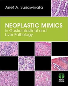 Neoplastic Mimics in Gastrointestinal and Liver Pathology 1st Edition