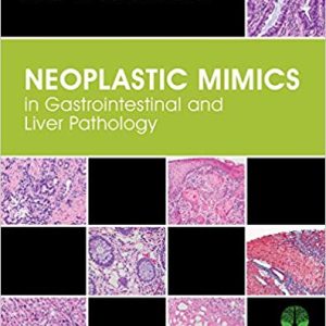 Neoplastic Mimics in Gastrointestinal and Liver Pathology 1st Edition