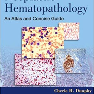 Neoplastic Hematopathology: An Atlas and Concise Guide 1st Edition