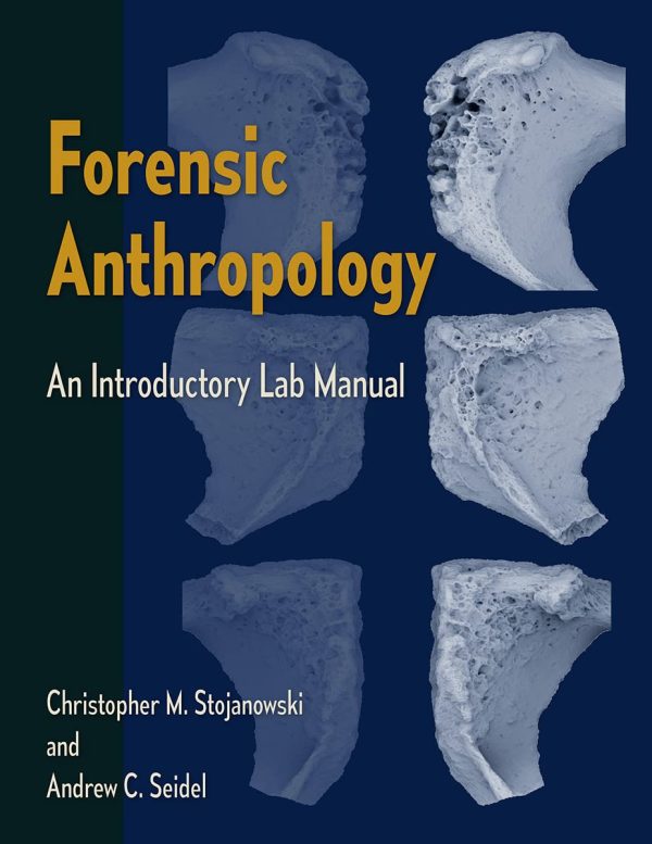 Forensic Anthropology: An Introductory Lab Manual Lab Manual Edition