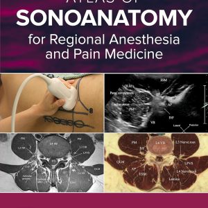 Atlas of Sonoanatomy for Regional Anesthesia and Pain Medicine