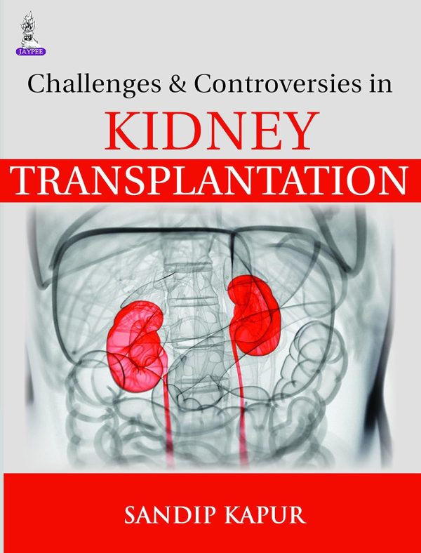 Challenges & Controversies in Kidney Transplantation