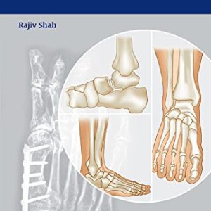 Handbook of Foot and Ankle Orthopedics 1st Edition