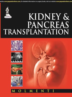 Kidney and Pancreas Transplantation: A Practical Guide (Current Clinical Urology)