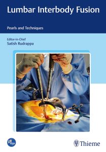 Lumbar Interbody Fusion Pearls and Techniques 1st Edition