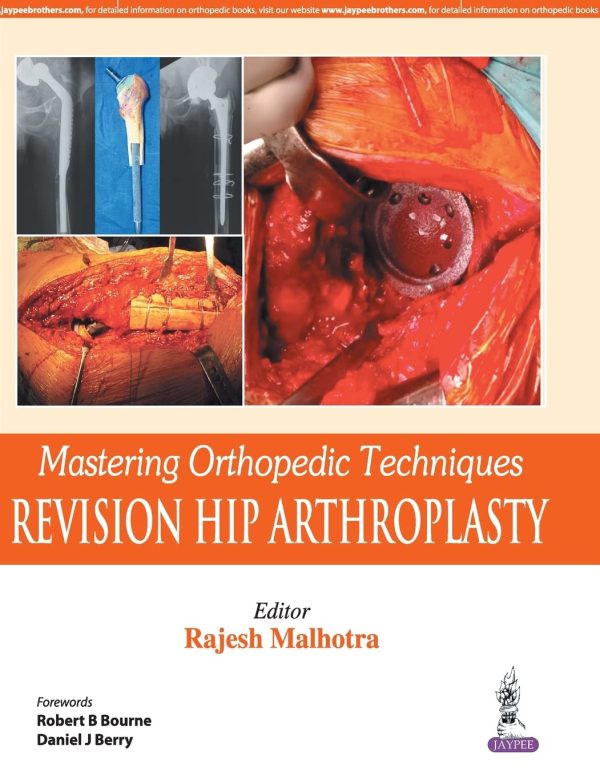 Mastering Orthopedic Techniques Revision Hip Arthroplasty 1st Edition