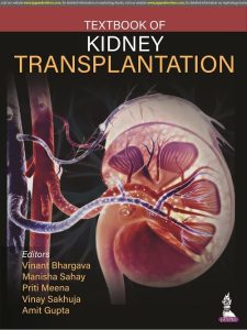 Kidney Transplantation – Principles and Practice: Expert Consult