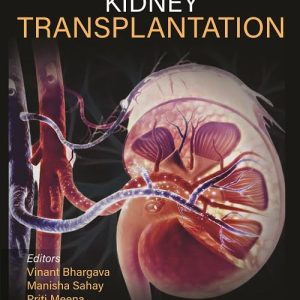 Kidney Transplantation – Principles and Practice: Expert Consult