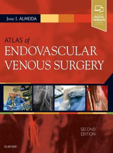 Atlas of Endovascular Venous Surgery: Expert Consult 2nd Edition (Videos)