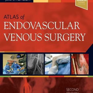 Atlas of Endovascular Venous Surgery: Expert Consult 2nd Edition (Videos)