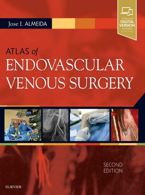 Atlas of Endovascular Venous Surgery: Expert Consult 2nd Edition