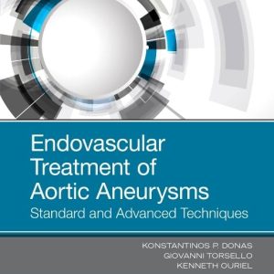 Endovascular Treatment of Aortic Aneurysms: Standard and Advanced Techniques 1st Edition