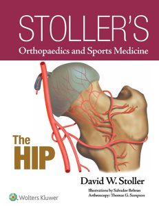 Stoller’s Orthopaedics and Sports Medicine The Hip First Edition