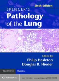 Spencer’s Pathology of the Lung Sixth Edition