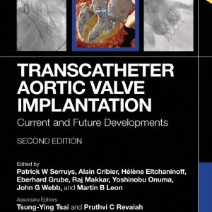 Transcatheter Aortic Valve Implantation  Current and Future Developments Second Edition