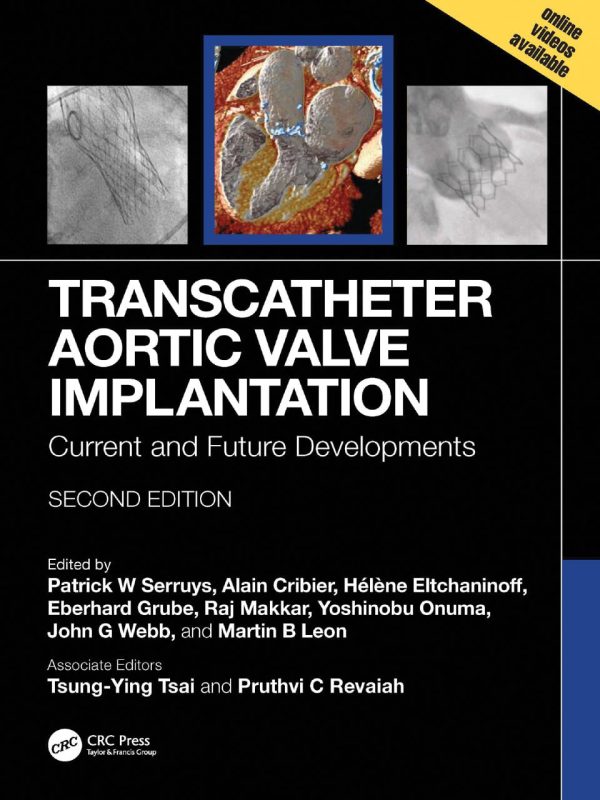 Transcatheter Aortic Valve Implantation  Current and Future Developments Second Edition