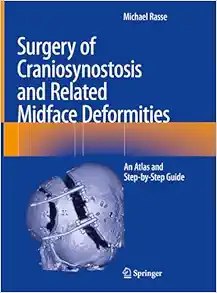 Surgery of Craniosynostosis and Related Midface Deformities  An Atlas and Step by Step Guide 2024 Edition