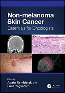 Non-melanoma Skin Cancer: Essentials for Oncologists First Edition