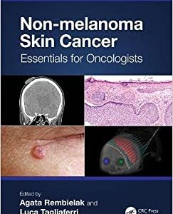 Non-melanoma Skin Cancer: Essentials for Oncologists First Edition