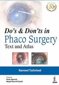 Do’s And  Dont’s in Phaco Surgery: Text and Atlas