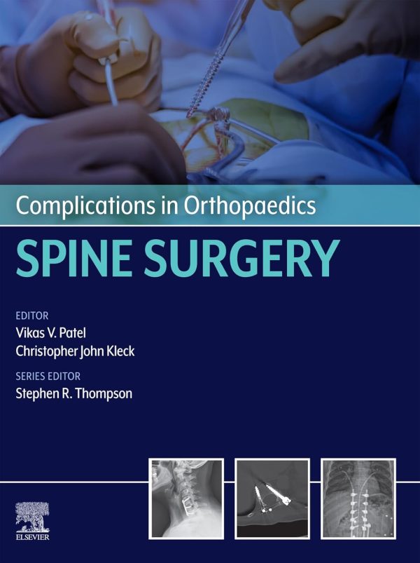 Complications in Orthopaedics Spine Surgery First Edition