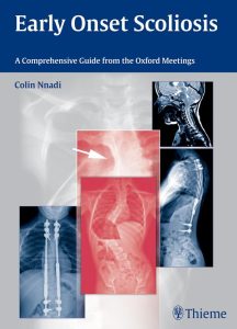 Early Onset Scoliosis  A Comprehensive Guide from the Oxford Meetings First Edition