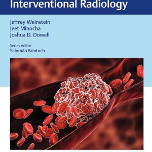 Venous Thromboembolism: A Practical Guide in Interventional Radiology First Edition