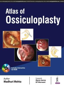 Atlas of Ossiculoplasty First Edition