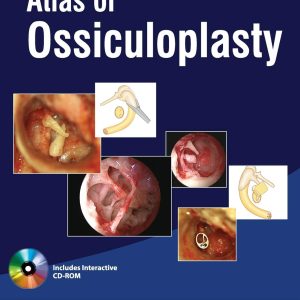 Atlas of Ossiculoplasty First Edition